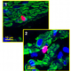 Image for article titled Could mammal bladders lead to amphibian-like organ regeneration in humans?